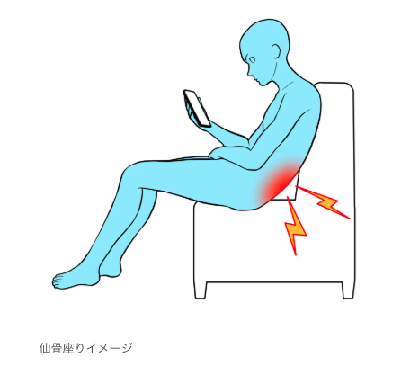 仙骨座り（ずっこけ座り）